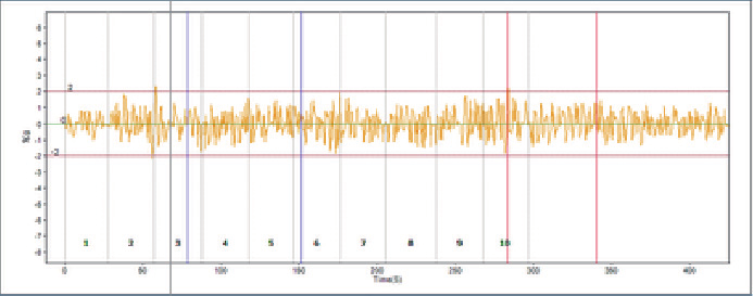 Rail vibration curve